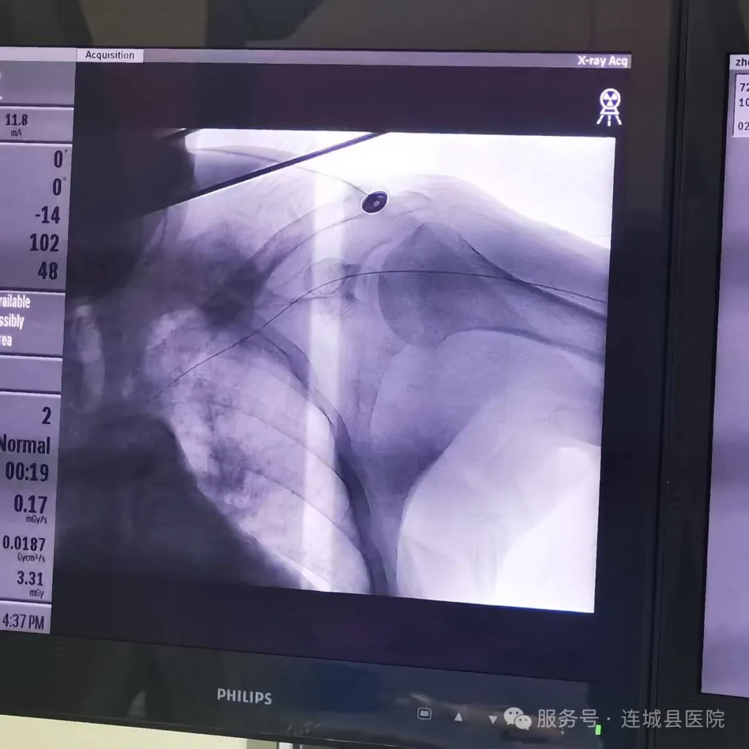 暫無圖片
